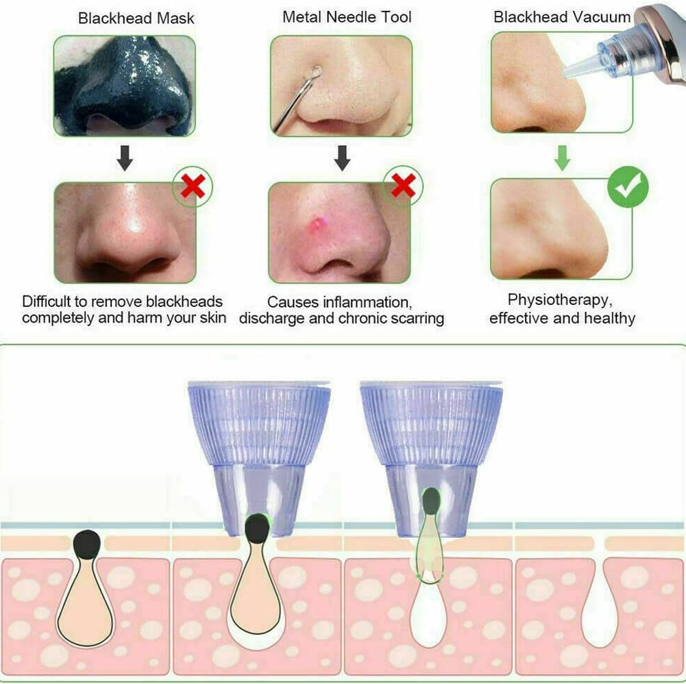 2-4 Pack Electric Blackhead Comedone Remover Pore Vacuum Cleaner Rechargeable (White, 2 Pack)