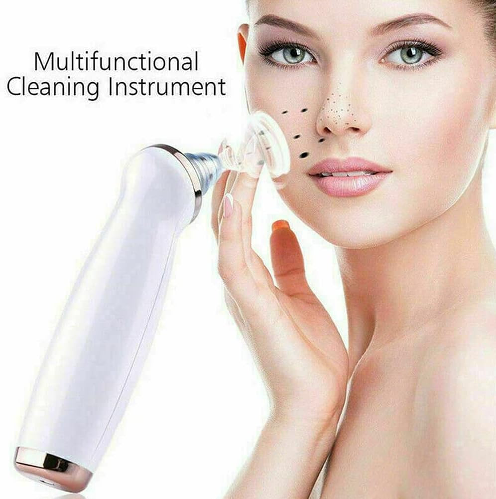 2-4 Pack Electric Blackhead Comedone Remover Pore Vacuum Cleaner Rechargeable (White, 2 Pack)