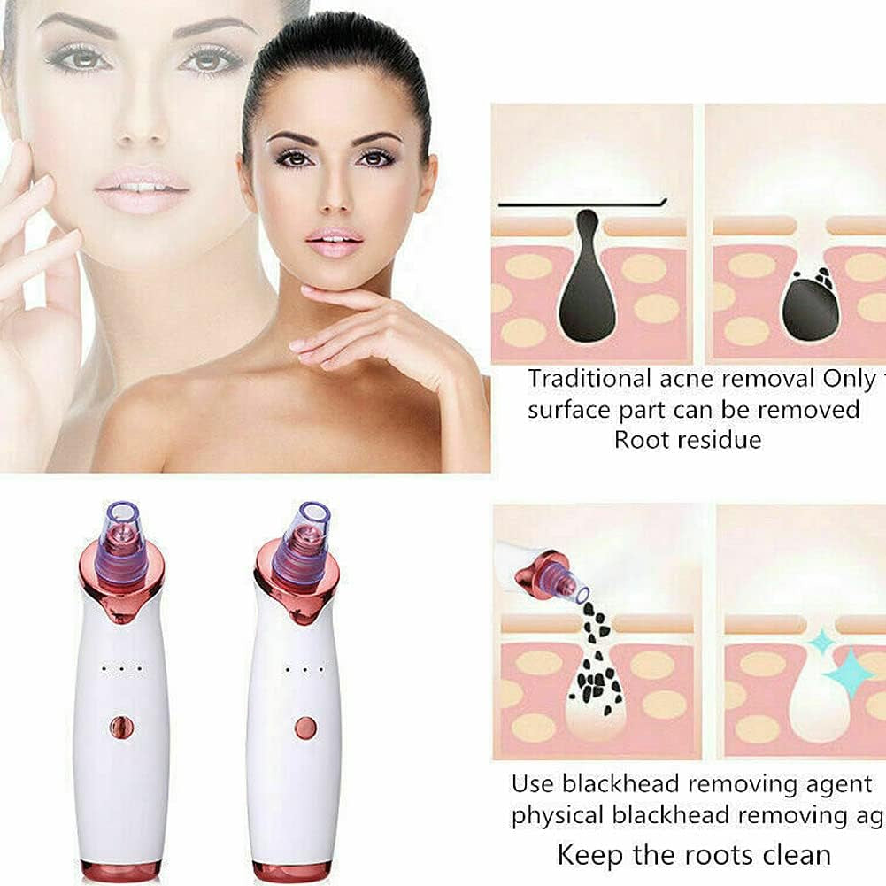 2-4 Pack Electric Blackhead Comedone Remover Pore Vacuum Cleaner Rechargeable (White, 2 Pack)