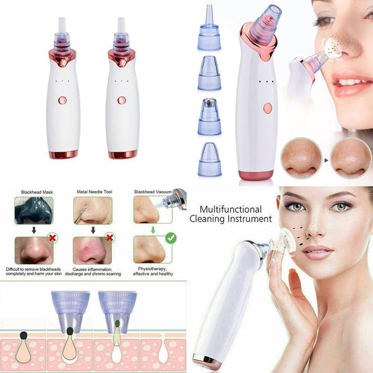 2-4 Pack Electric Blackhead Comedone Remover Pore Vacuum Cleaner Rechargeable (White, 2 Pack)